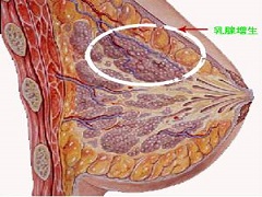 帕博西尼等CDK4/6抑制剂可有效治疗乳腺癌