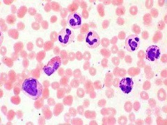 维特克拉可以有效降低患者的死亡风险