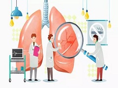 凡德他尼可以联合治疗非小细胞肺癌