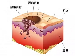 曲美替尼联合达拉菲尼可以持久控制患者病情