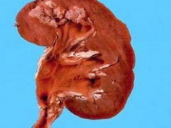 服用帕唑帕尼对肝脏有损伤吗？