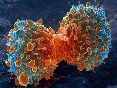 奥拉帕尼治疗BRCA突变卵巢癌