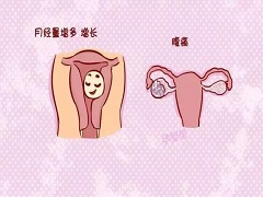 子宫内膜癌细胞案例图