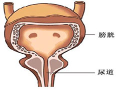 关于膀胱癌的几种治疗方法