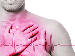 心梗的早期症状是什么？