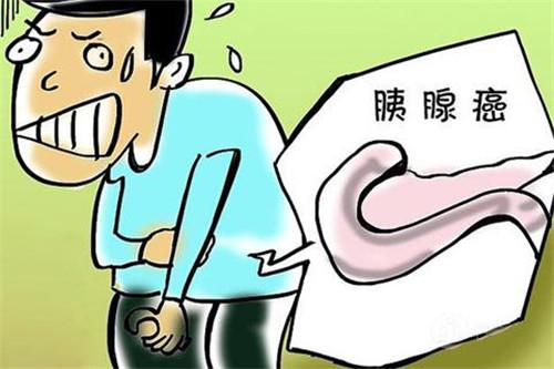 预防胰腺癌，我们应该养成哪些好习惯？