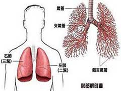 同样是肺癌海外就医却得到了不同的解决方案